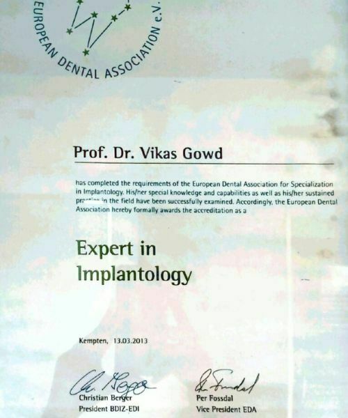 Dr. Gowds' Dental Hospitals |Dental Implants