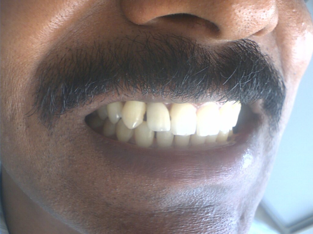 Dr. Gowds' Dental Hospitals |Braces