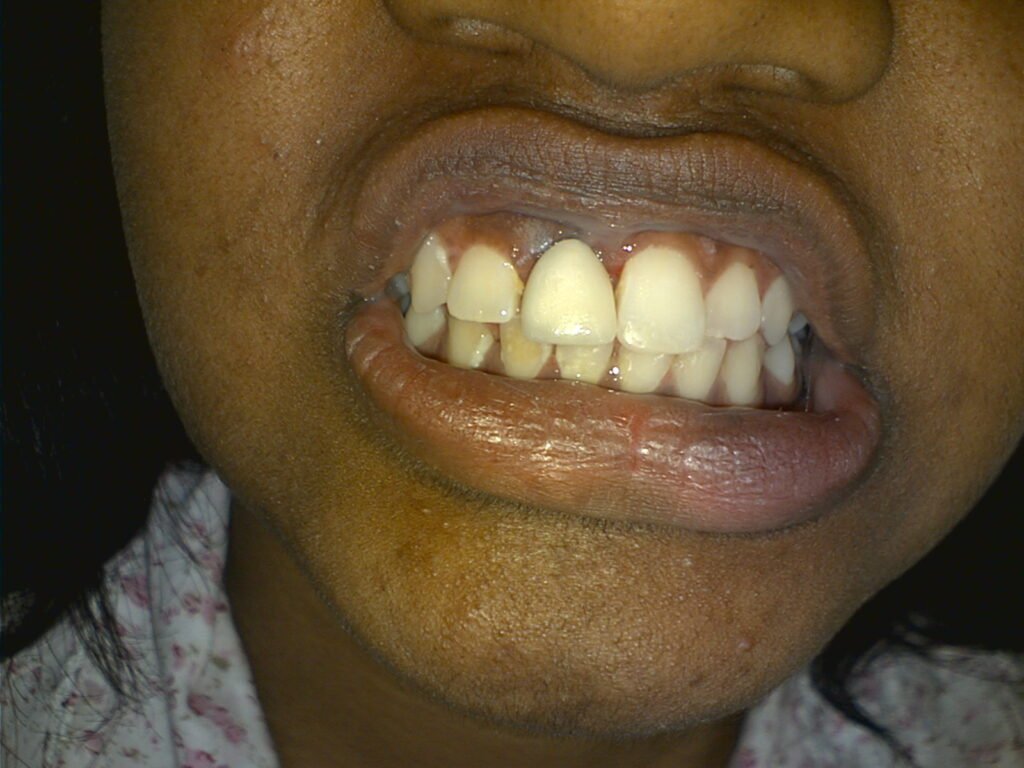 Dr. Gowds' Dental Hospitals |Braces