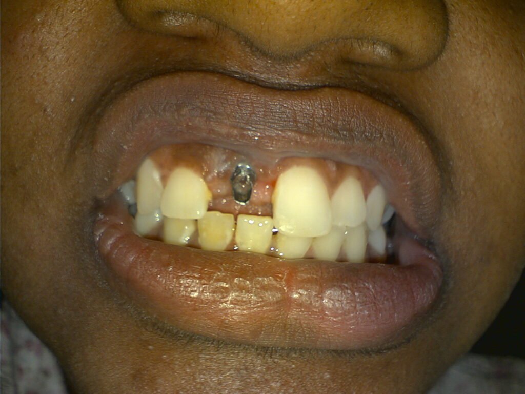 Dr. Gowds' Dental Hospitals |Braces