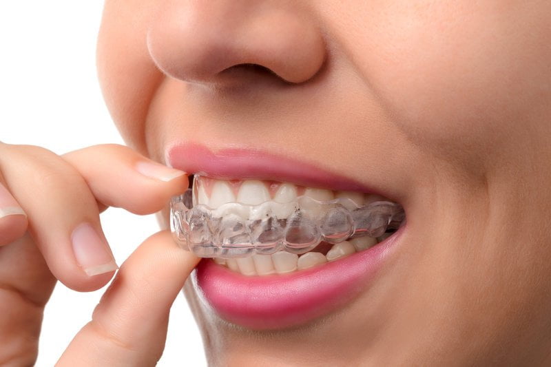 Dr. Gowds' Dental Hospitals |Dental Implants