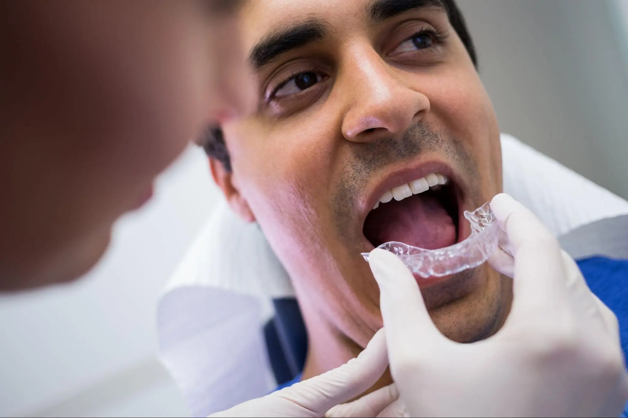 invisalign treatment in Hyderabad invisalign treatment in Hyderabad