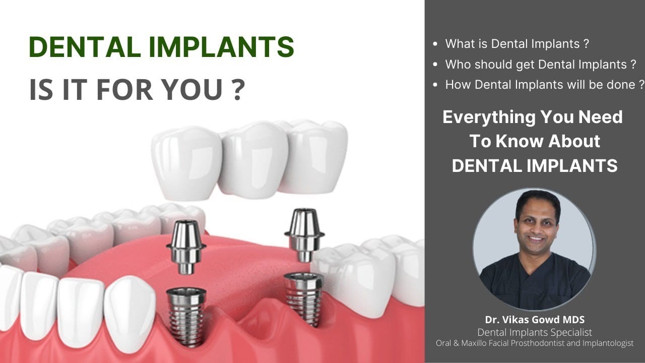 dental implant in hyderabad best