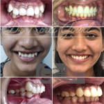 Dr. Gowds' Dental Hospitals |Our Media