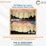 Dr. Gowds' Dental Hospitals |Our Media