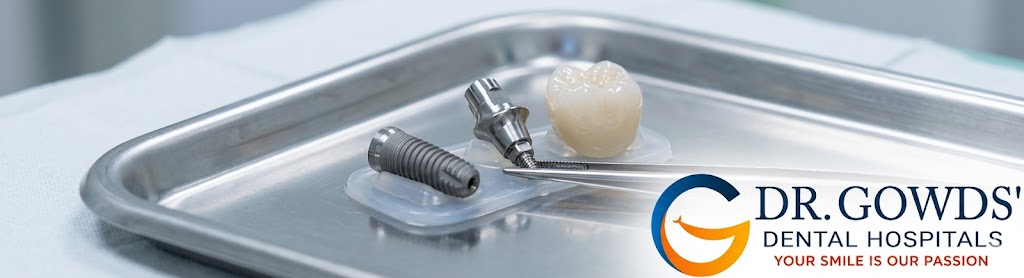 Dr. Gowds' Dental Hospitals | Why Dr Gowd’s Dental Hospitals Rank Among the Top 10 Dental Hospitals in Hyderabad for Advanced Care