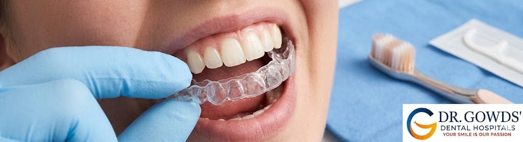 Clear Aligner Application and Hygiene Close-up