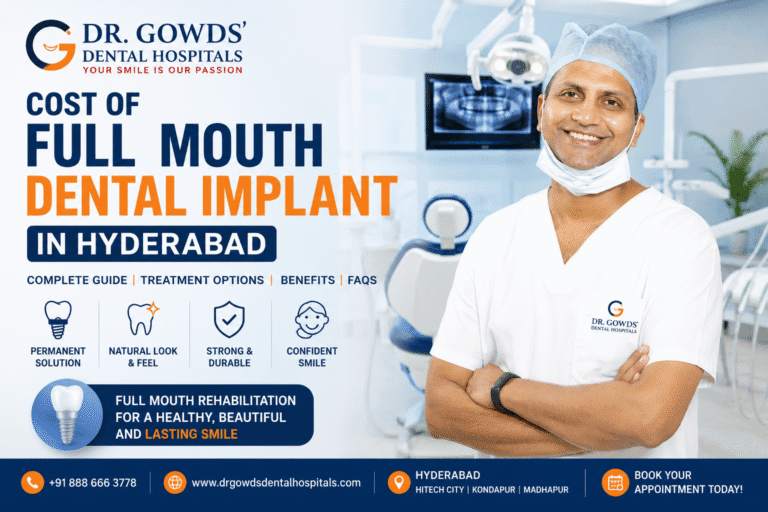 Advanced Full Mouth Dental Implants in Hyderabad – Cost & Treatment Guide