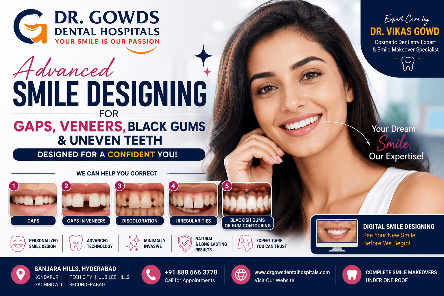 Advanced Smile Designing for Gaps, Veneers, Black Gums & Uneven Teeth