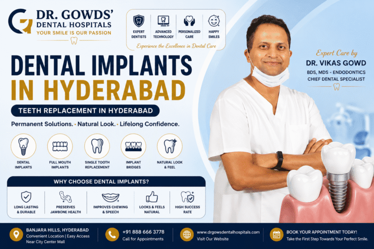 Dental Implants in Hyderabad | Teeth Replacement in Hyderabad