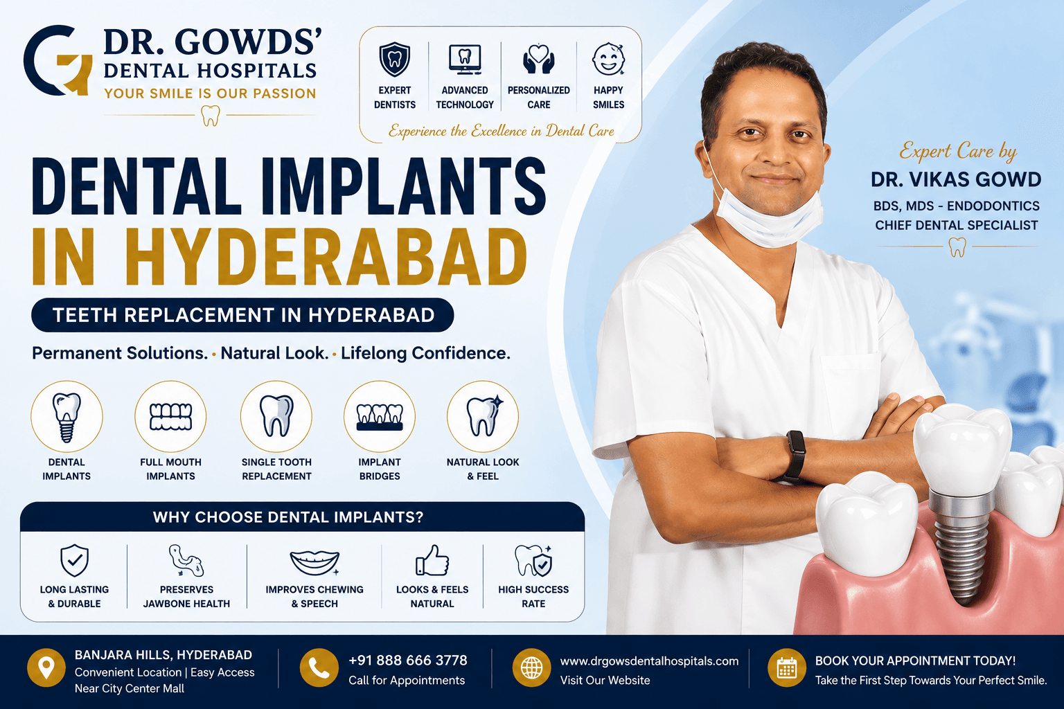 Dental Implants in Hyderabad | Teeth Replacement in Hyderabad