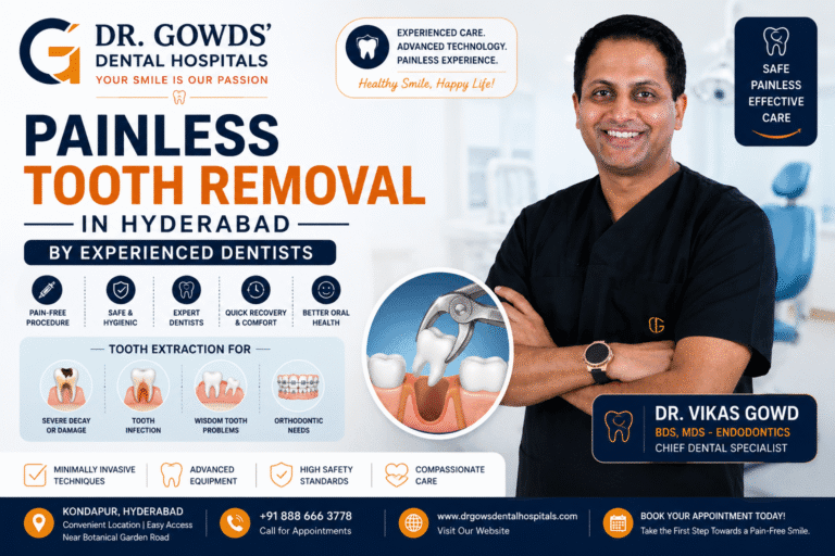 Painless Tooth Removal in Hyderabad by Experienced Dentists