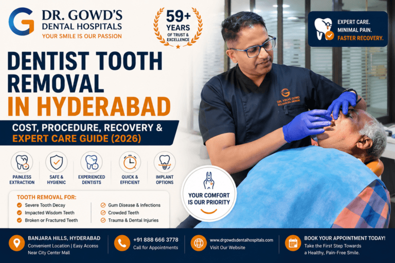 Tooth Removal in Hyderabad