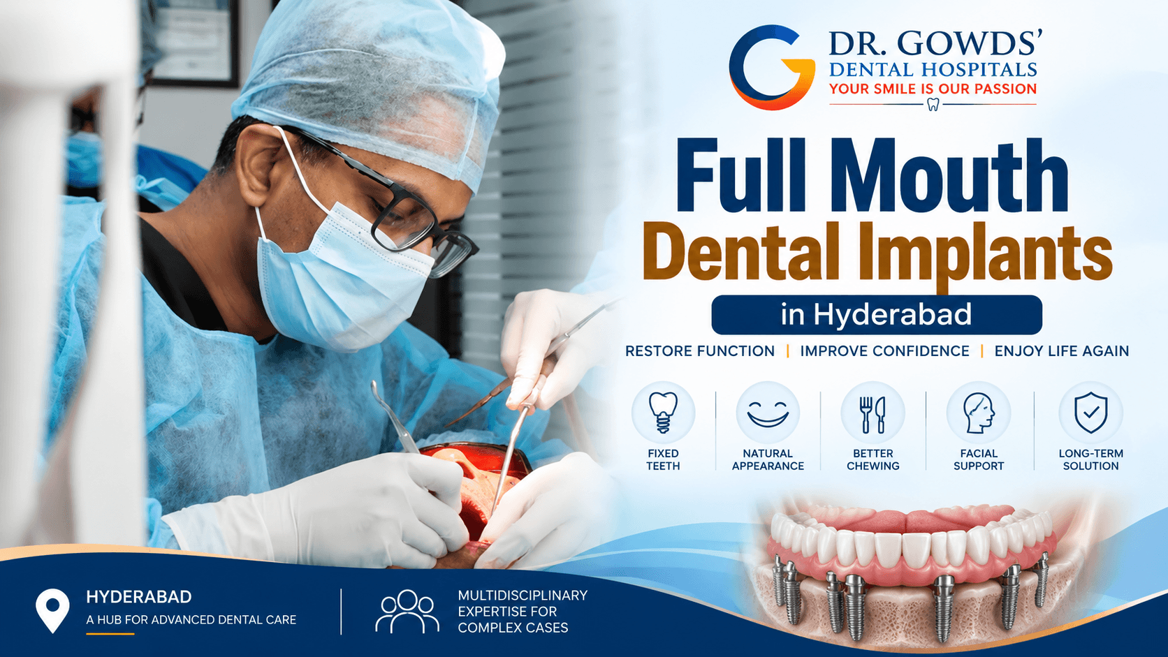 Dental Implants