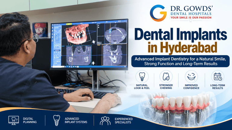 Dental Implants in Hyderabad