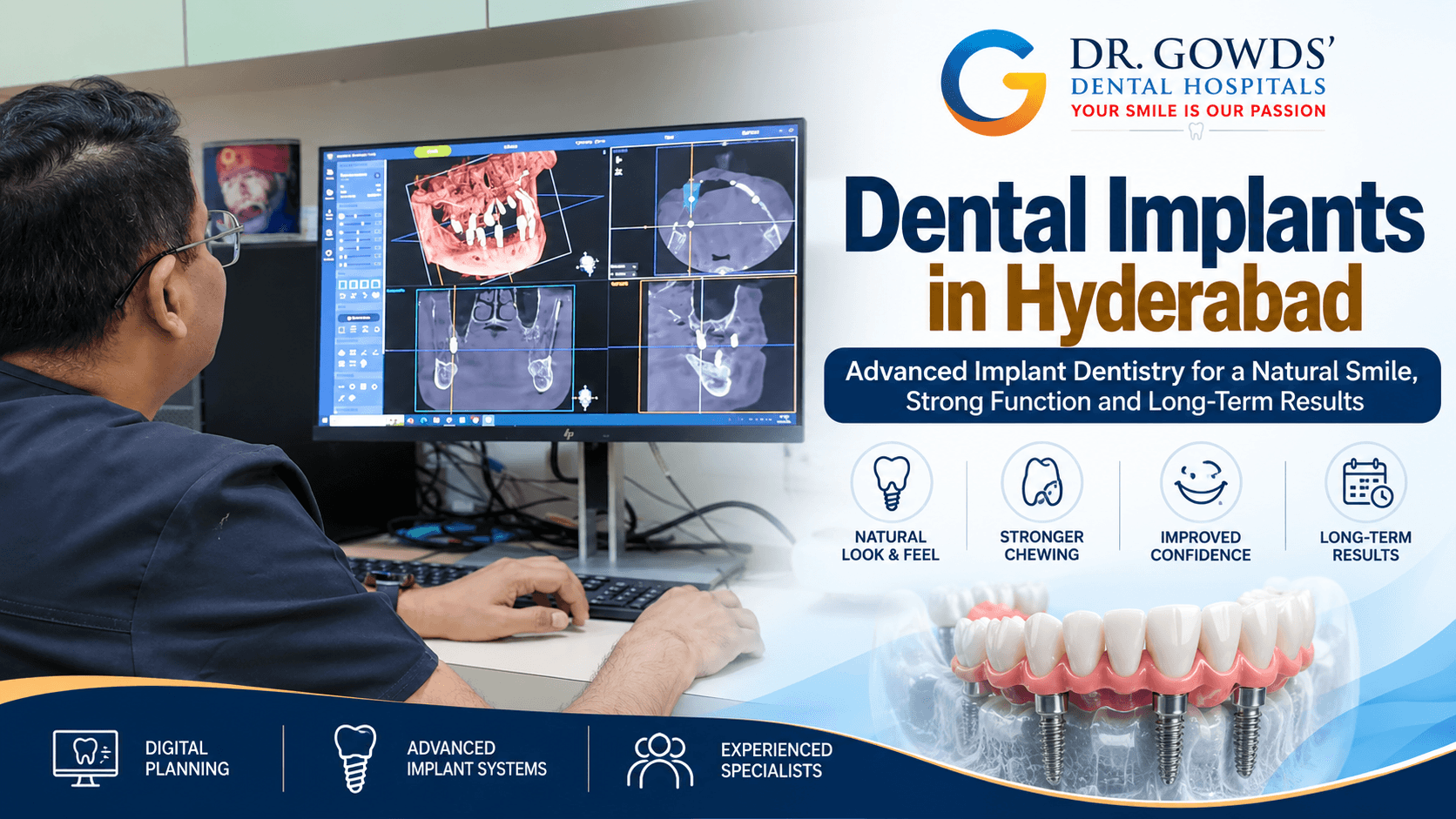 Dental Implants in Hyderabad