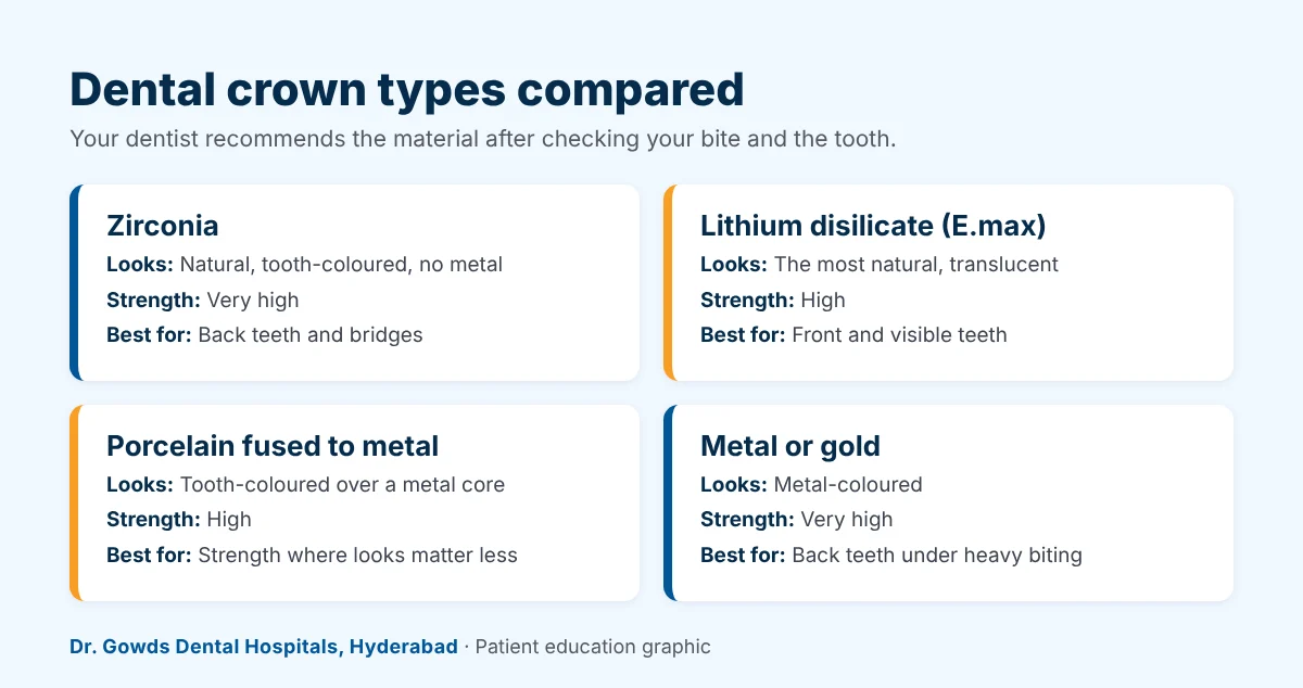 Comparison of dental crown types: zirconia, lithium disilicate (E.max), porcelain fused to metal, and metal or gold
