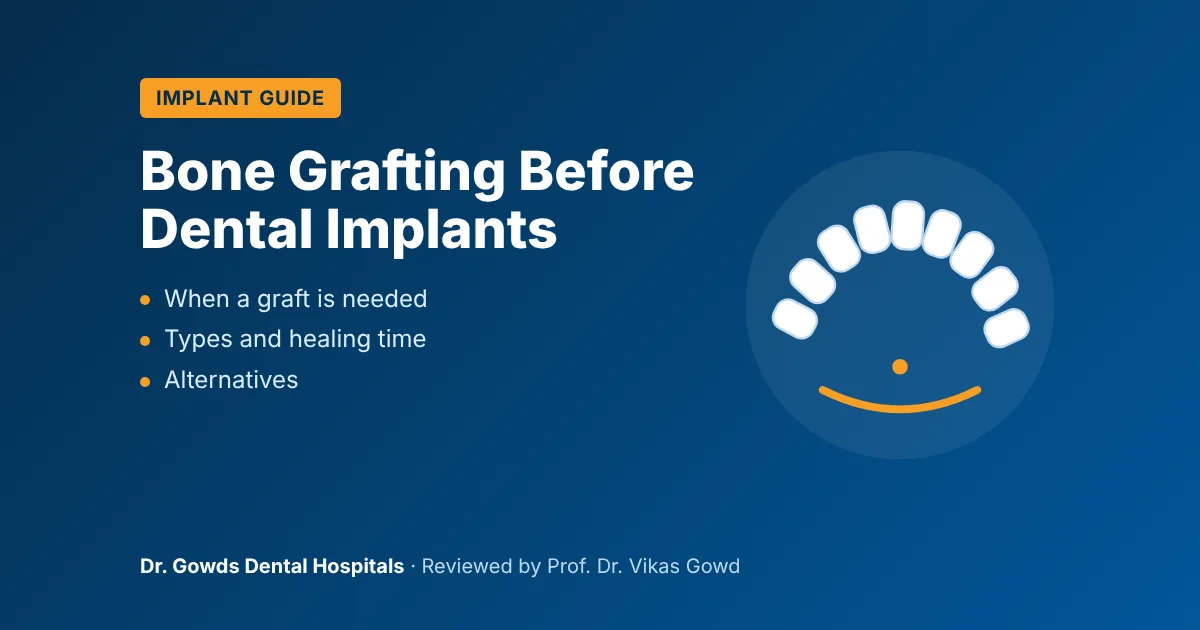 Dental bone grafting before implants: when it is needed and what to expect, reviewed by Prof. Dr. Vikas Gowd