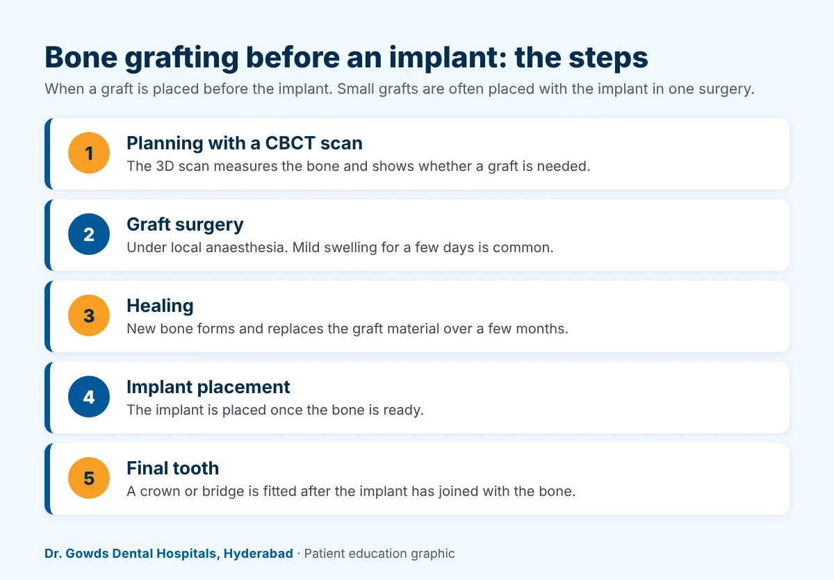 graft timeline Dental bone grafting timeline: CBCT scan, graft placed, healing period, implant placed, final tooth fitted