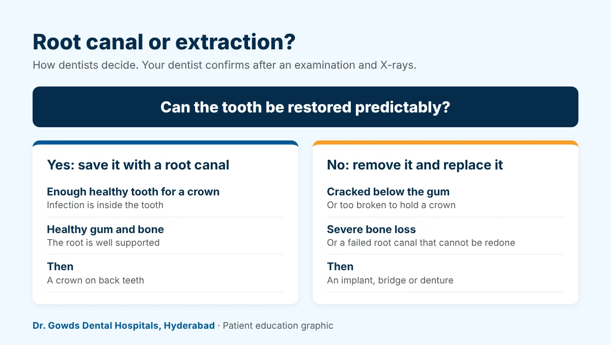 rct decision Root canal or extraction decision guide: when a tooth can be saved with a root canal and when extraction followed by replacement is better